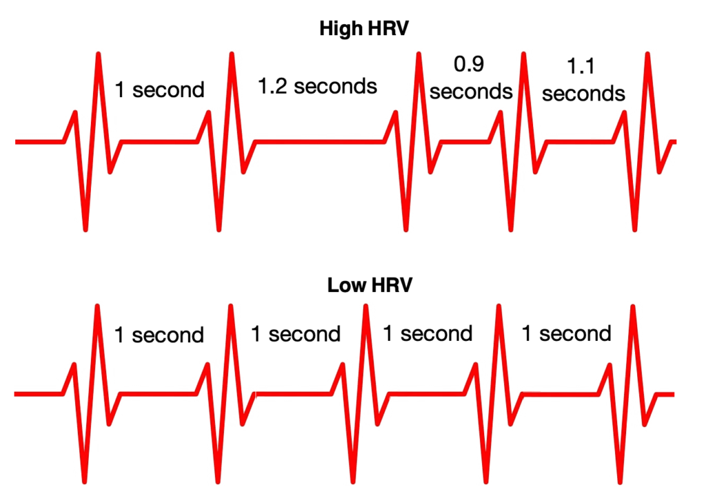 heart rate variability diagram